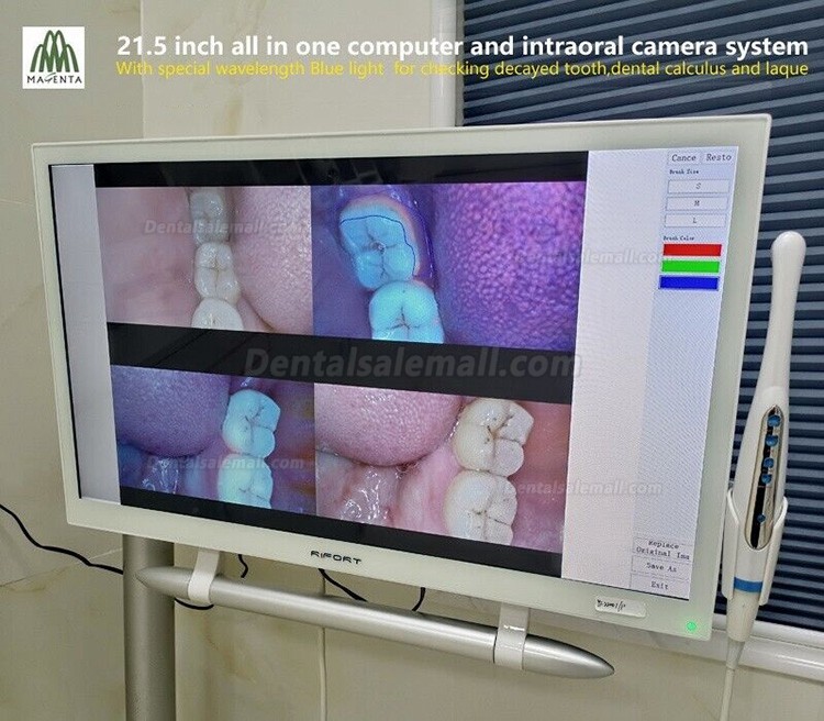 Magenta YF-2200P+ 21.5 Inch LCD Monitor Touch Screen Intraoral Camera VGA+HDMI